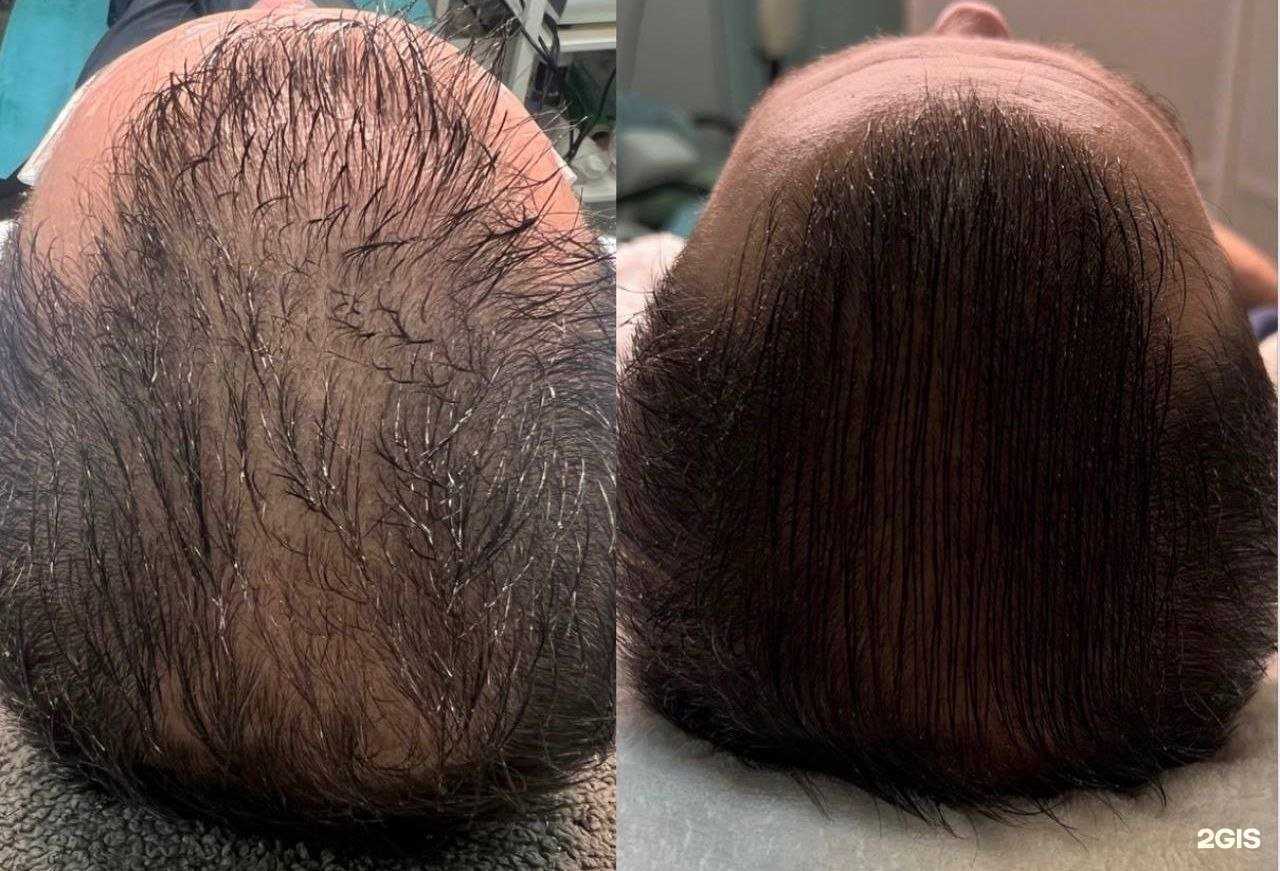 Отзывы на компанию Кабинет мастера холодной плазмы в г. Норильск c фото