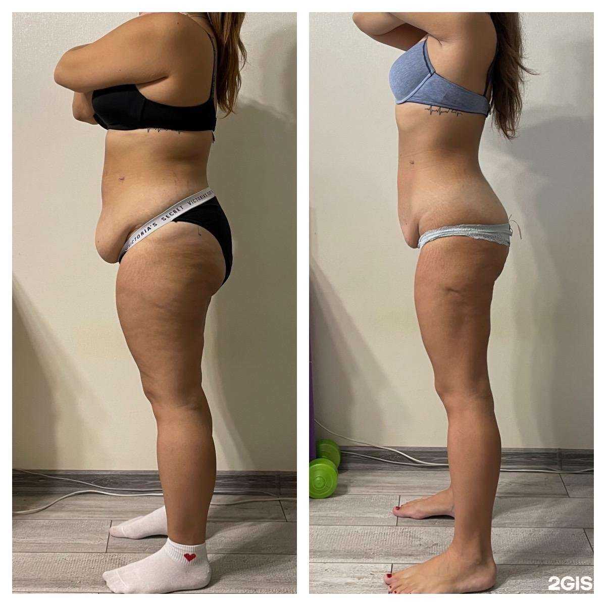 Отзывы на компанию Стройное тело в Краснодаре c фото