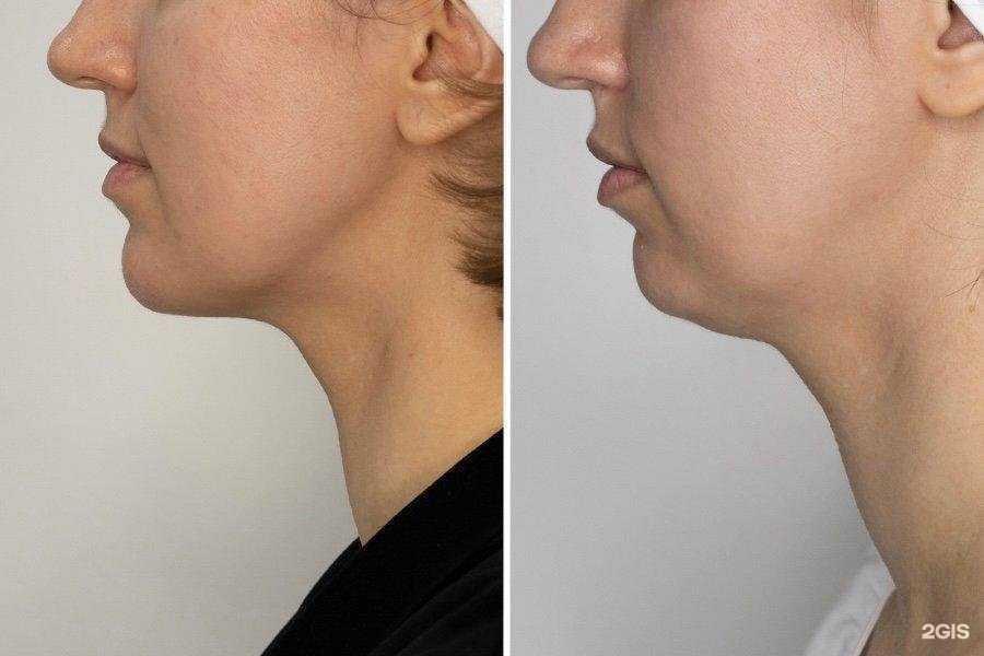 Отзывы на компанию Студия косметологии в Череповце c фото