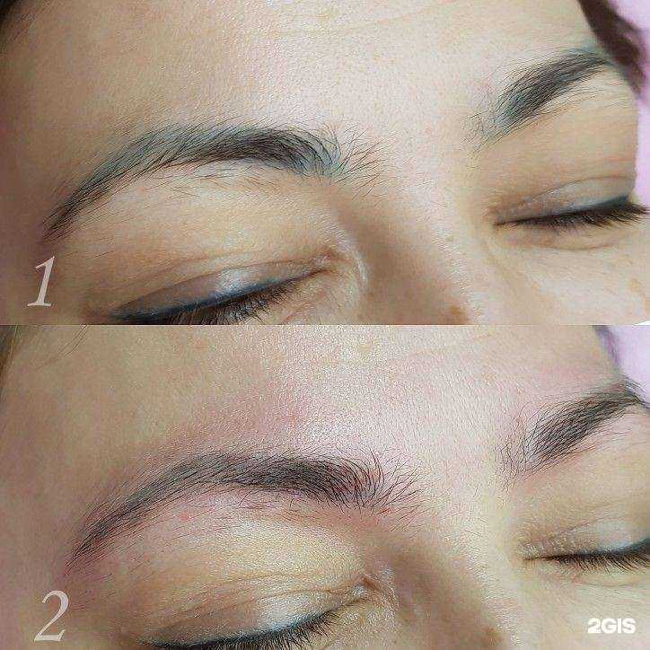 Отзывы на компанию Студия по удалению татуажа в г. Сургут c фото