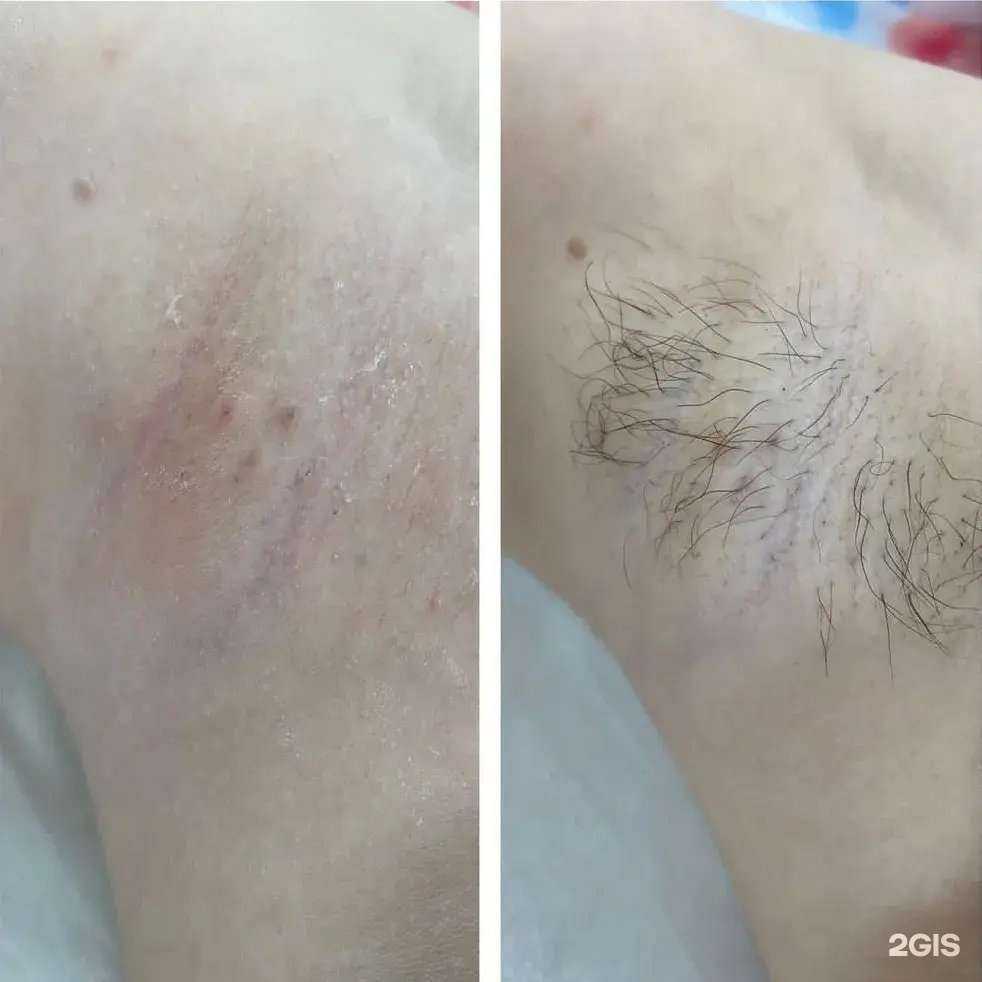 Отзывы на компанию Кабинет депиляции в г. Волжск c фото