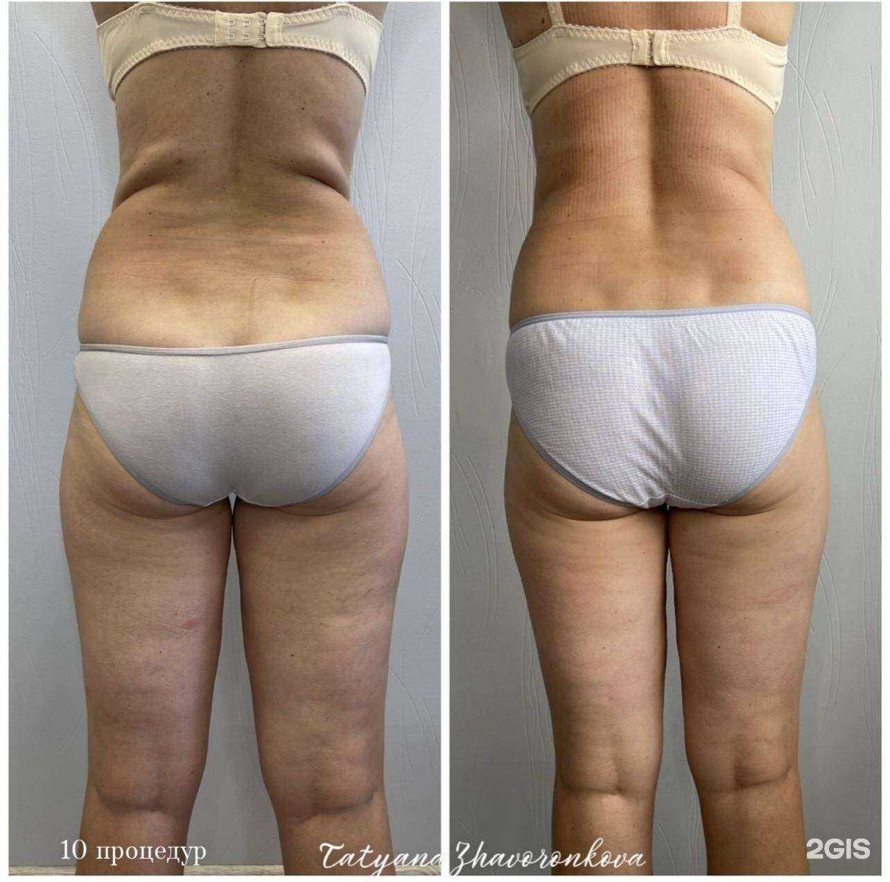 Отзывы на компанию Студия массажа в г. Киров c фото