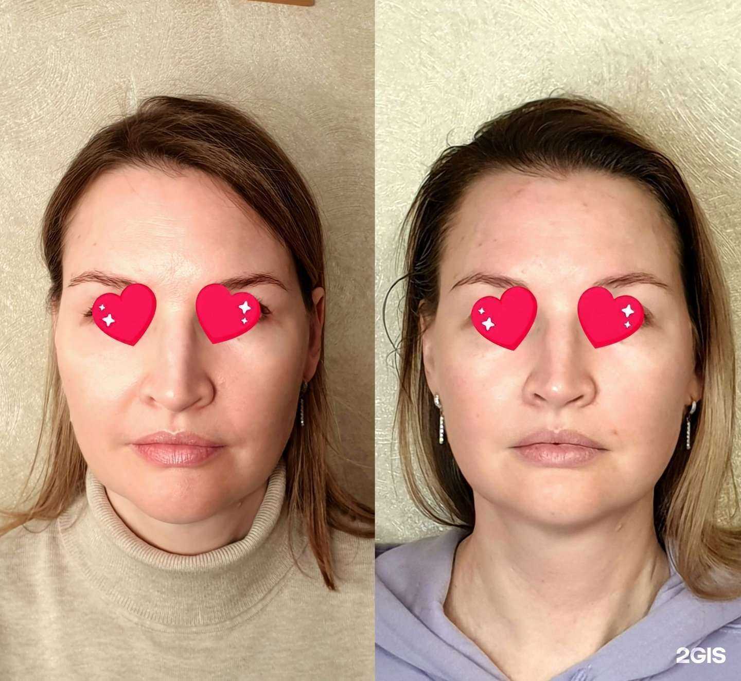 Отзывы на компанию Molodaya_ya в Южно-Сахалинске c фото