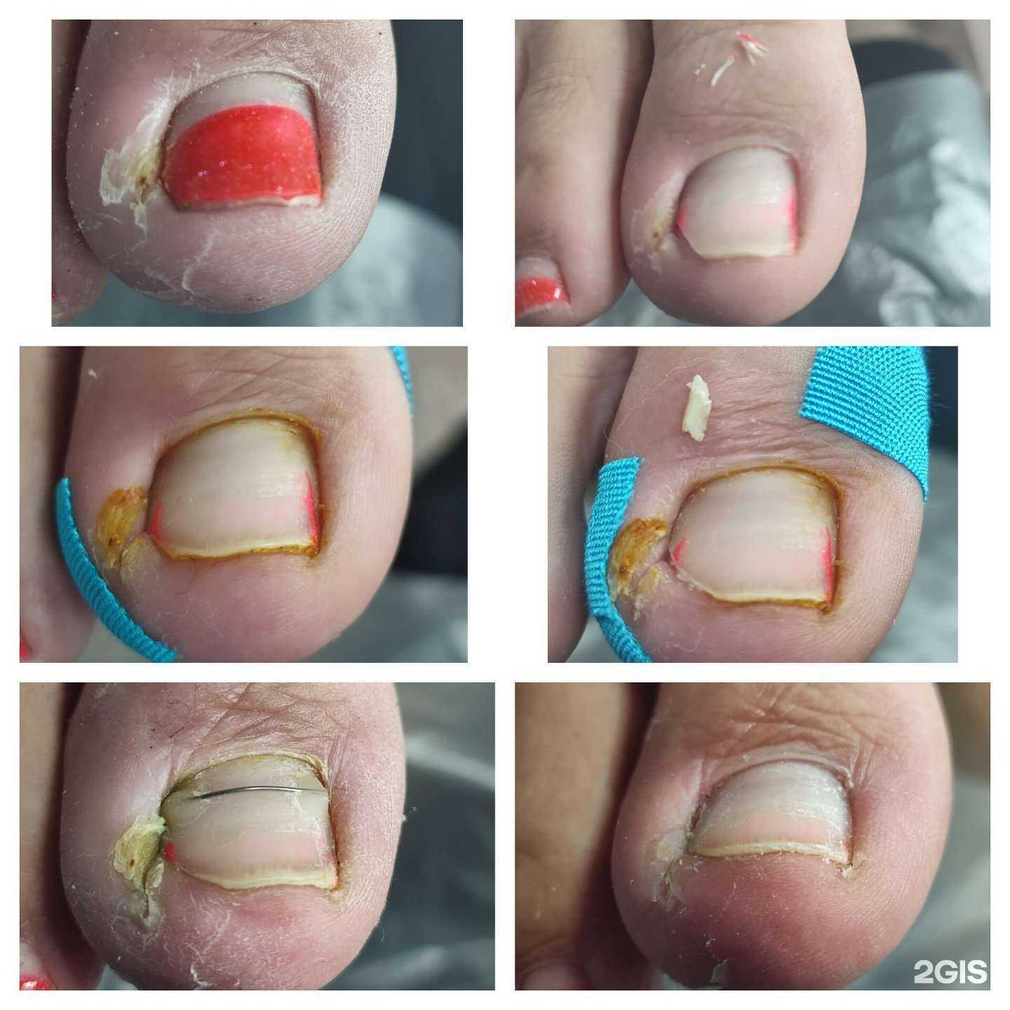 Отзывы на компанию Студия подологии в Ульяновске c фото