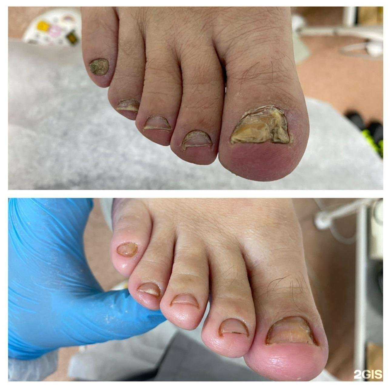 Отзывы на компанию Кабинет подолога в г. Прокопьевск c фото