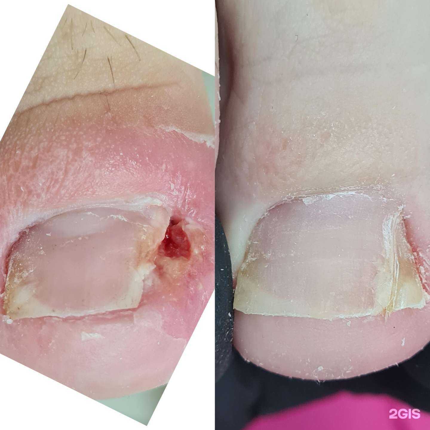 Отзывы на компанию Кабинет подолога Марины Климкиной в г. Пенза c фото