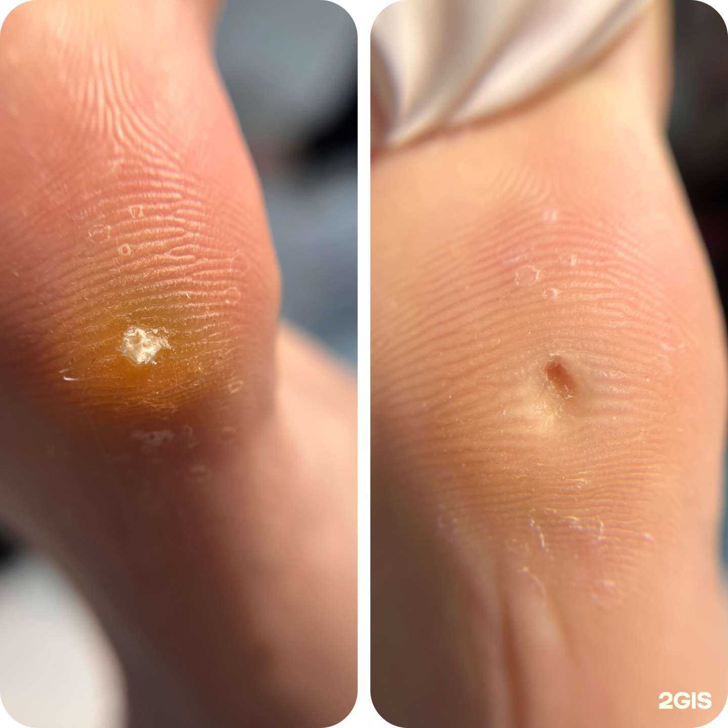 Отзывы на компанию Кабинет подолога в г. Набережные Челны c фото