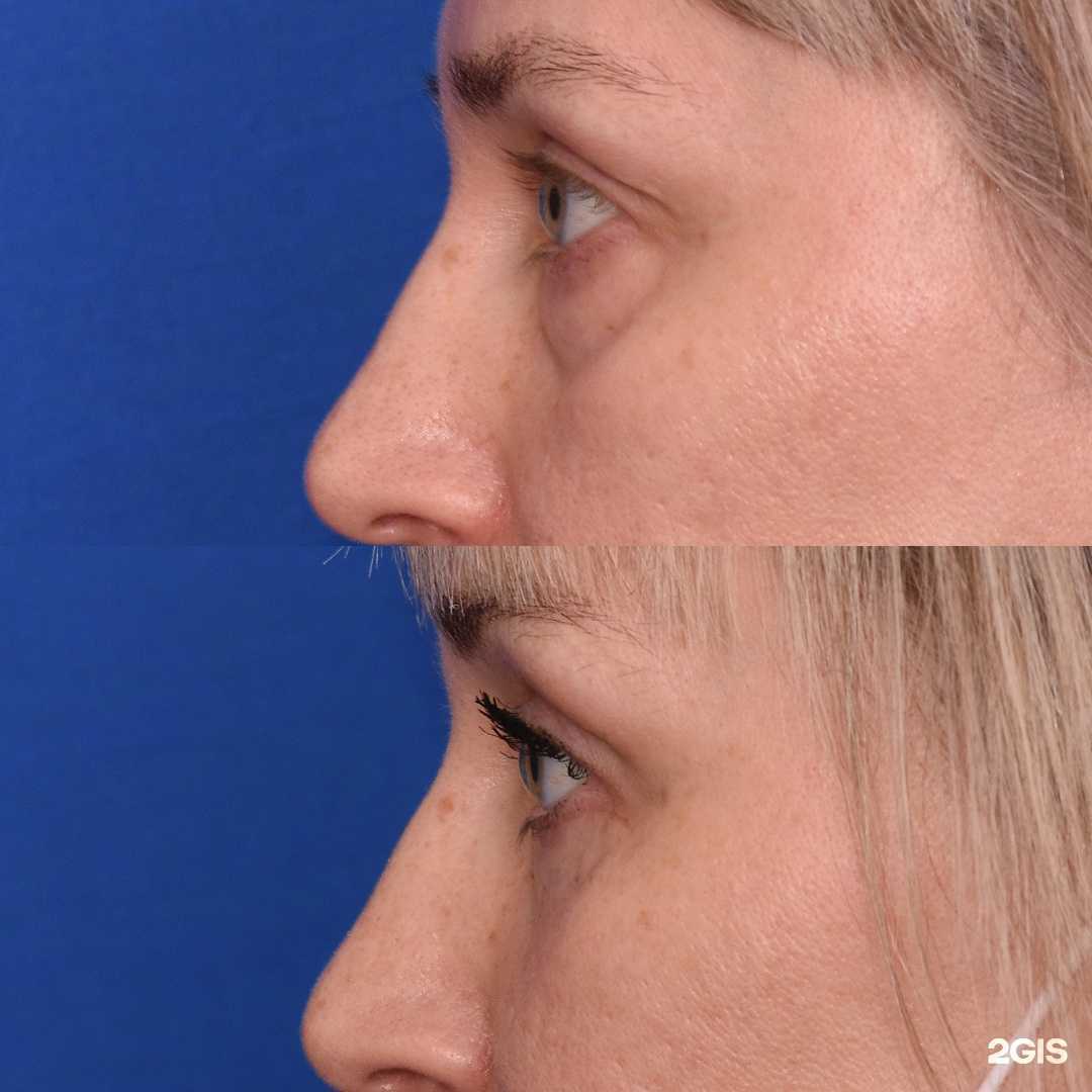 Отзывы на компанию Пластический хирург Образцов Е.Ю. в Воронеже c фото