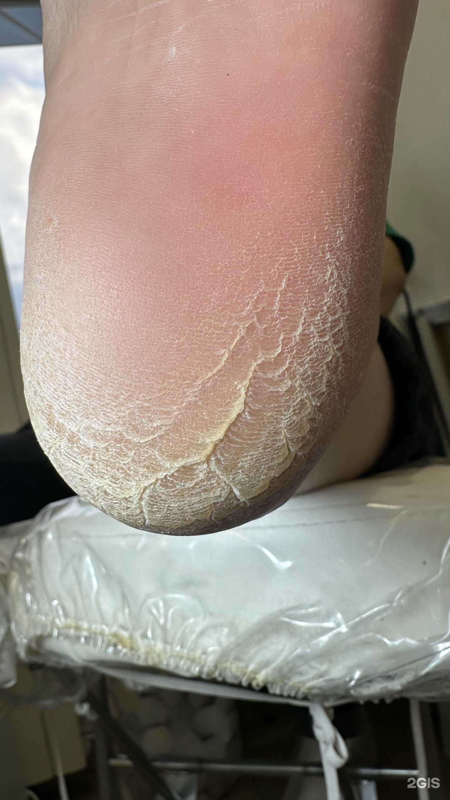 Отзывы на компанию Кабинет здоровых стоп и ногтей Кристины Манкевич в г. Ачинск c фото