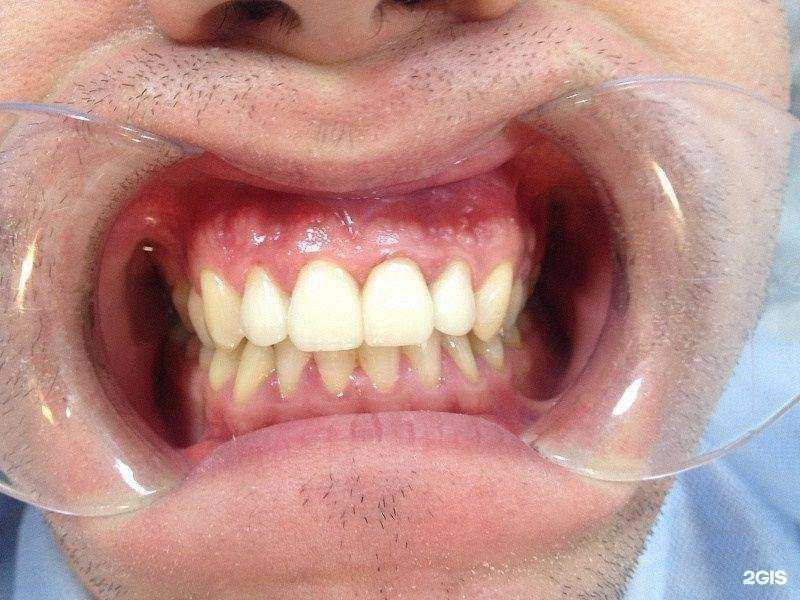 Отзывы на компанию Мастер Дент, стоматологическая клиника в Канаше c фото