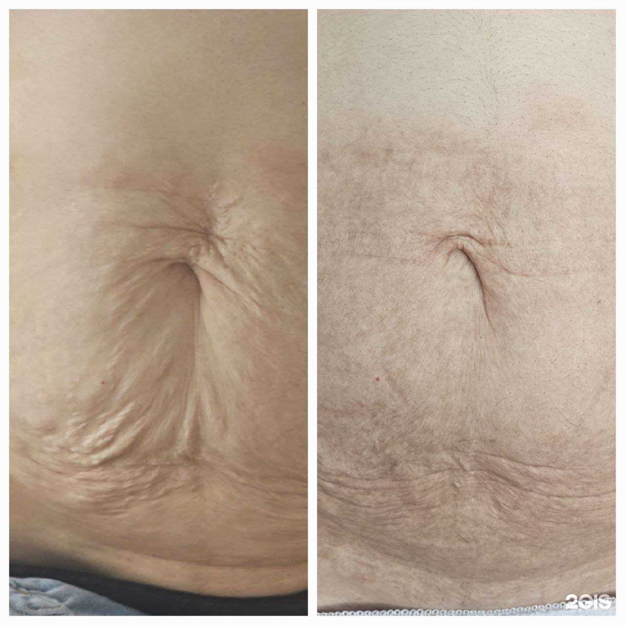 Отзывы на компанию Студия холодной плазмы в Иркутске c фото