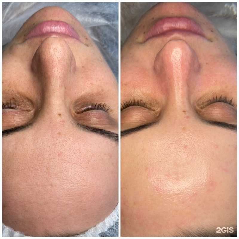 Отзывы на компанию Эдэм в Петропавловске-Камчатском c фото