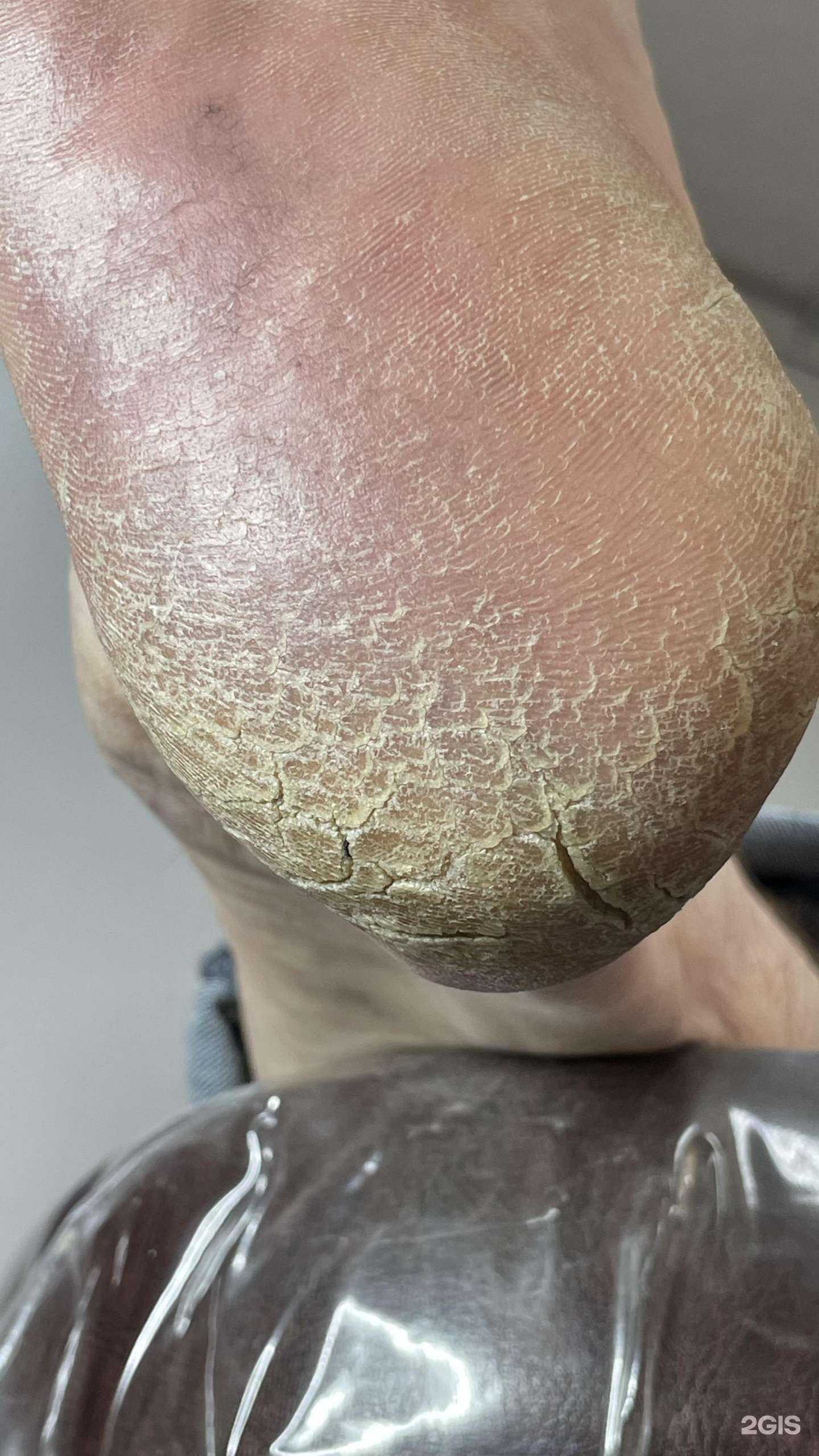 Отзывы на компанию Кабинет эстетики стопы в Северодвинске c фото