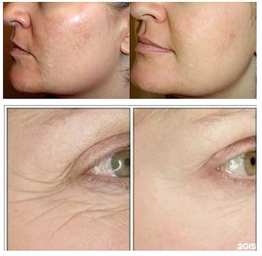 Отзывы на компанию Лав в г. Анапа c фото