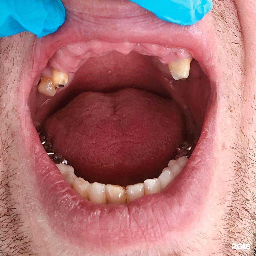 Отзывы на компанию Эстедент в Пензе c фото