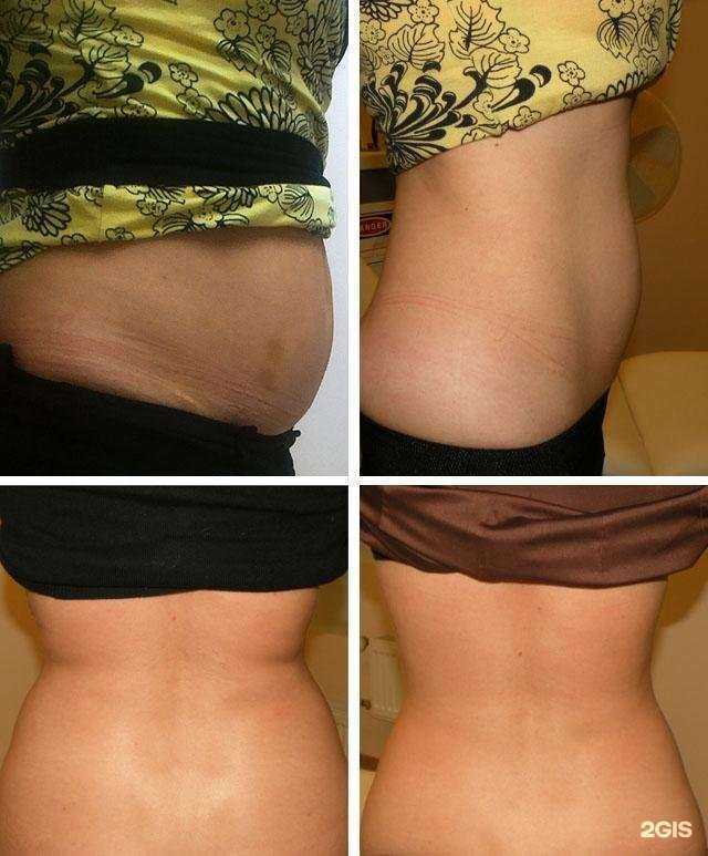 Отзывы на компанию Медикон в г. Елец c фото