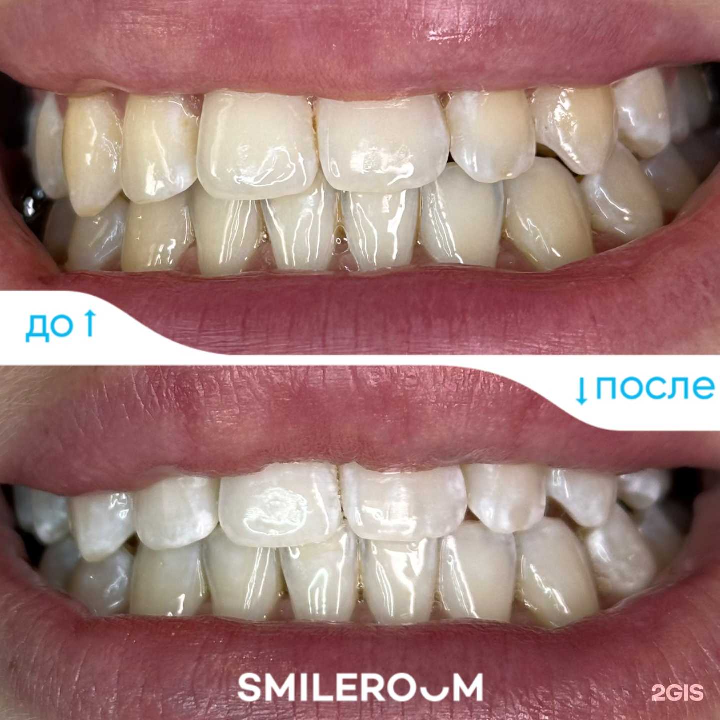 Отзывы на компанию SmileRoom_Lipetsk расширение не соответствует рубрике в Липецке c фото