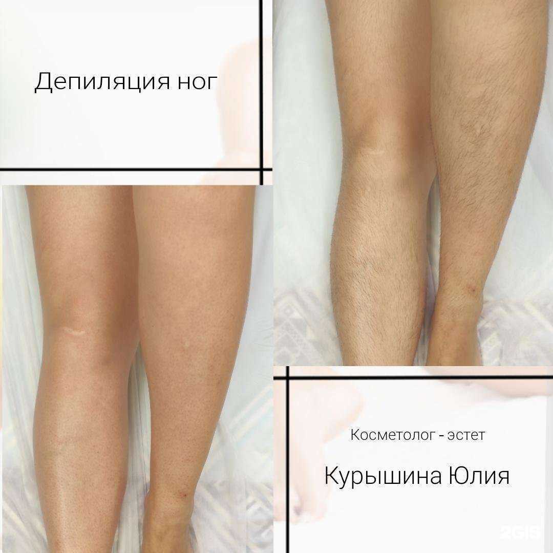 Отзывы на компанию Кабинет депиляции в Липецке c фото