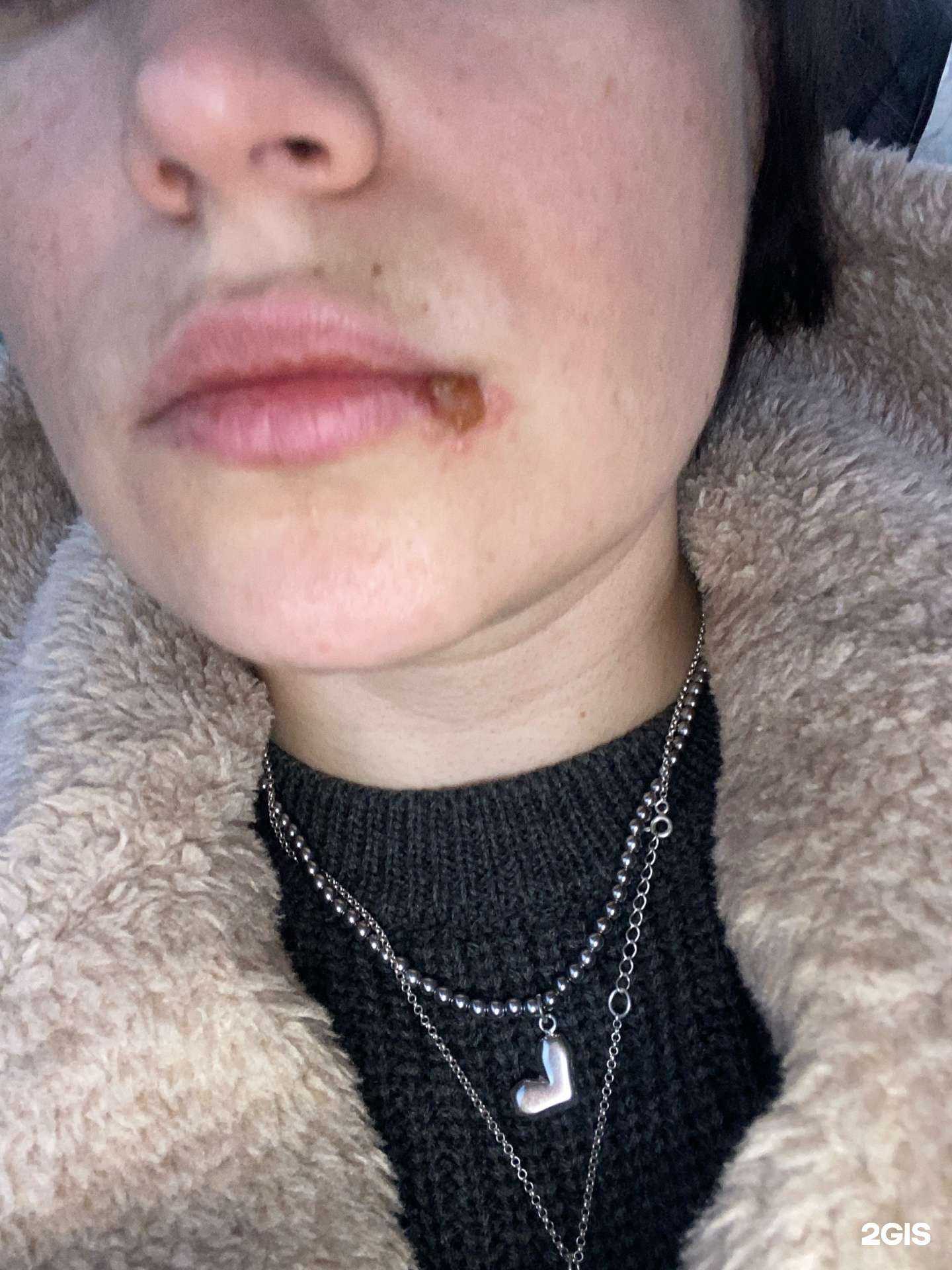 Отзывы на компанию ДентАС в Ярославле c фото