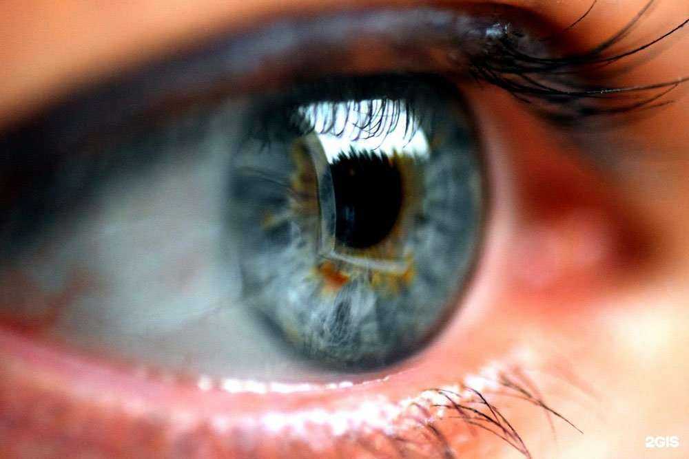 Отзывы на компанию Клиника лазерной микрохирургии глаза А. Тихова в г. Ярославль c фото