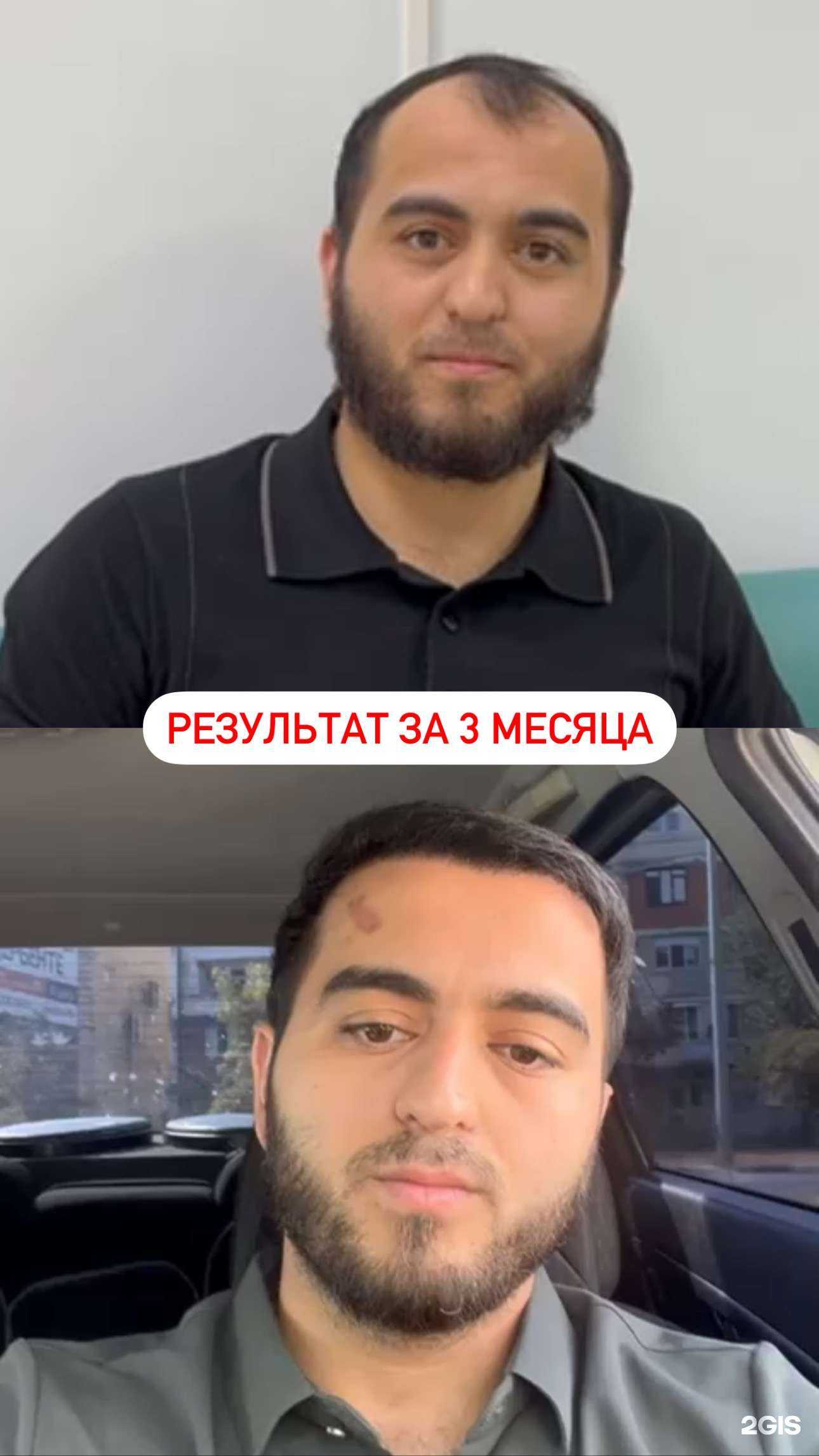 Отзывы на компанию Usisha hair clinic в г. Махачкала c фото