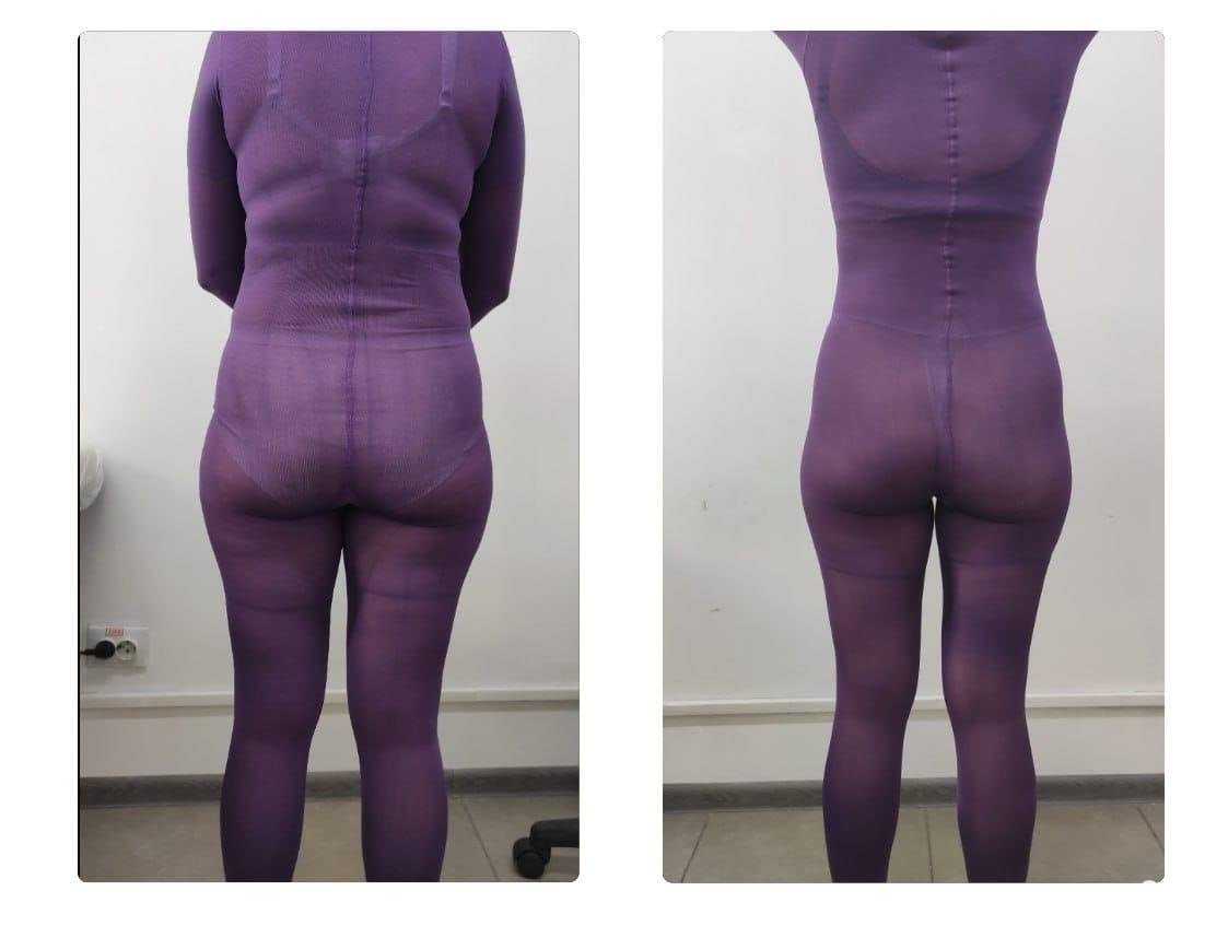 Отзывы на компанию Тонус есть в г. Липецк c фото