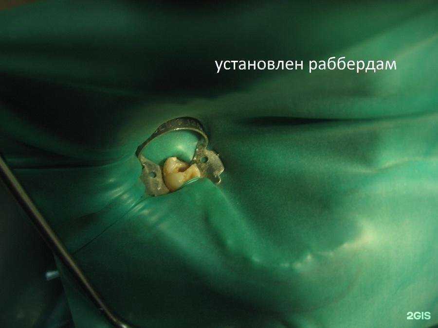 Отзывы на компанию Аполлония в Энгельсе c фото