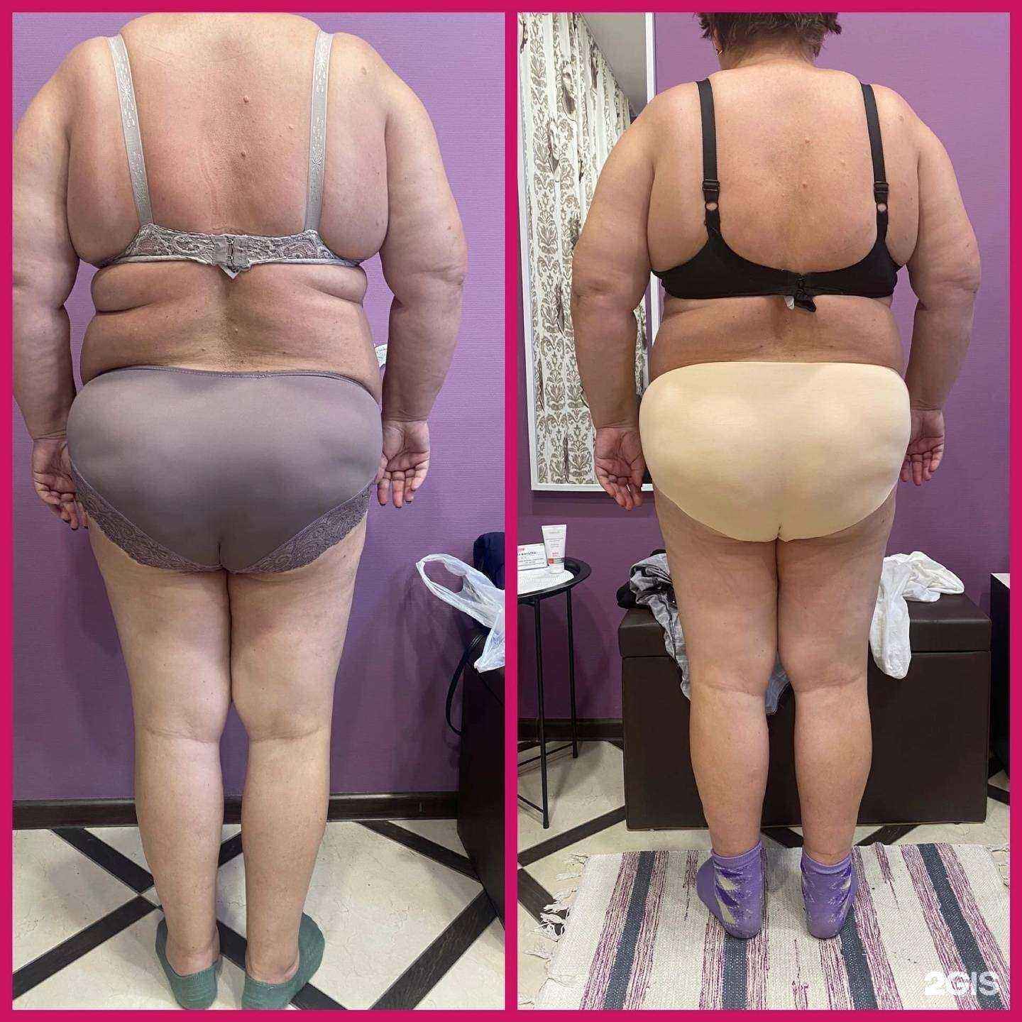 Отзывы на компанию Без Фильтра в Твери c фото