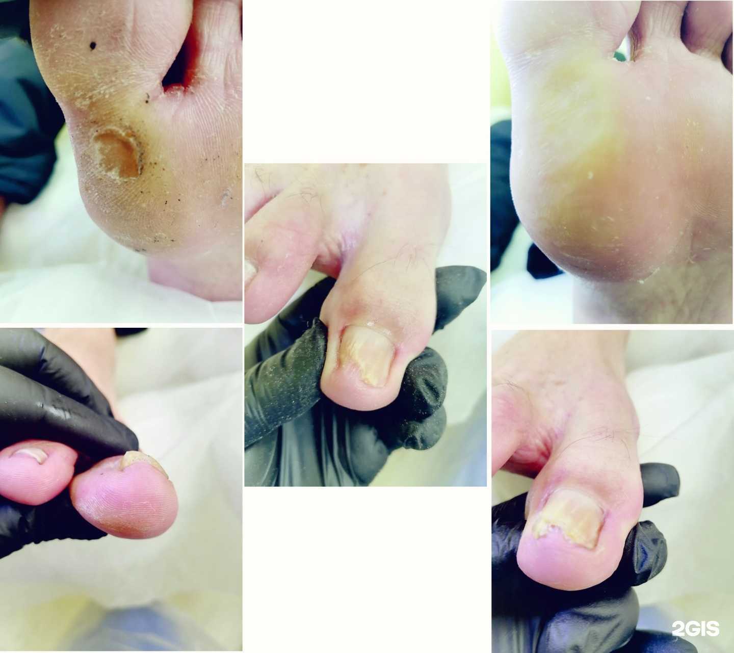 Отзывы на компанию Кабинет подологии и педикюра в Йошкар-Оле c фото