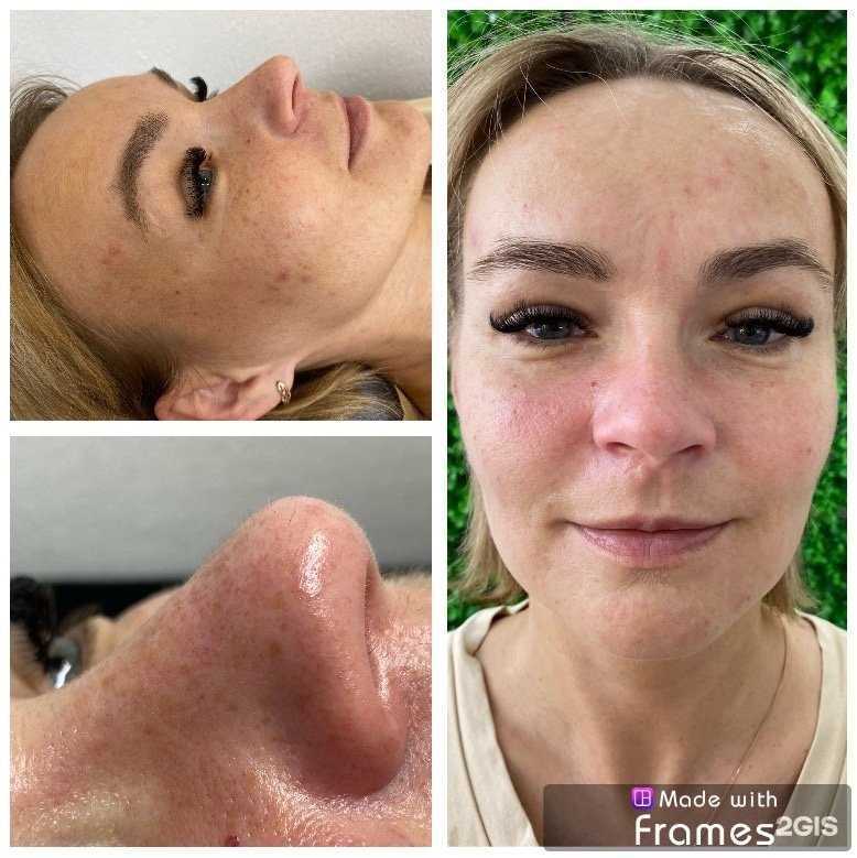 Отзывы на компанию Студия перманентного макияжа и эстетической косметологии в Пскове c фото