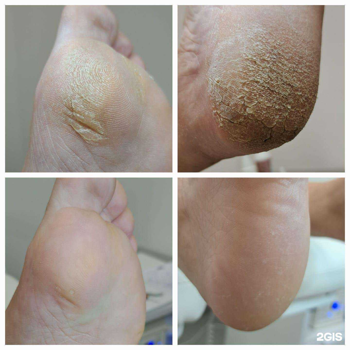 Отзывы на компанию Лайм в г. Абакан c фото