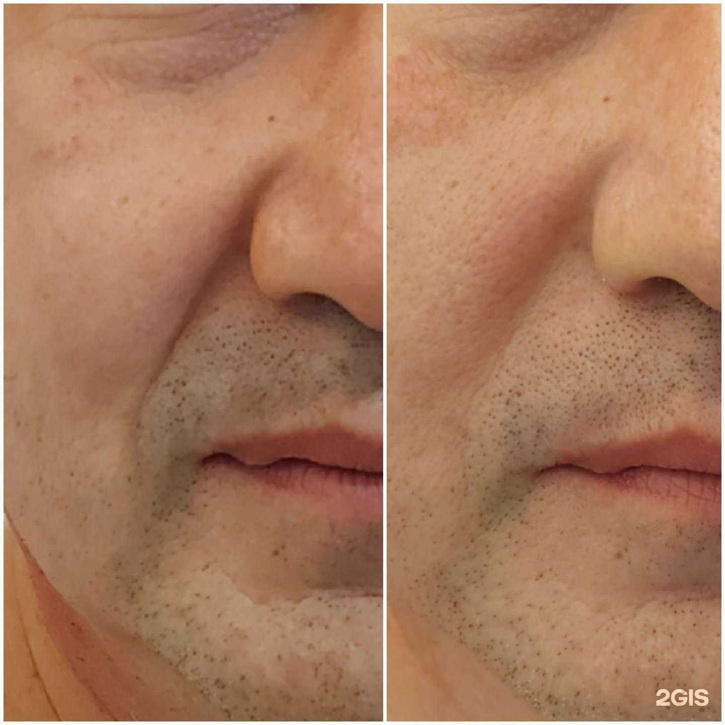 Отзывы на компанию Katyafacemassage в Уфе c фото