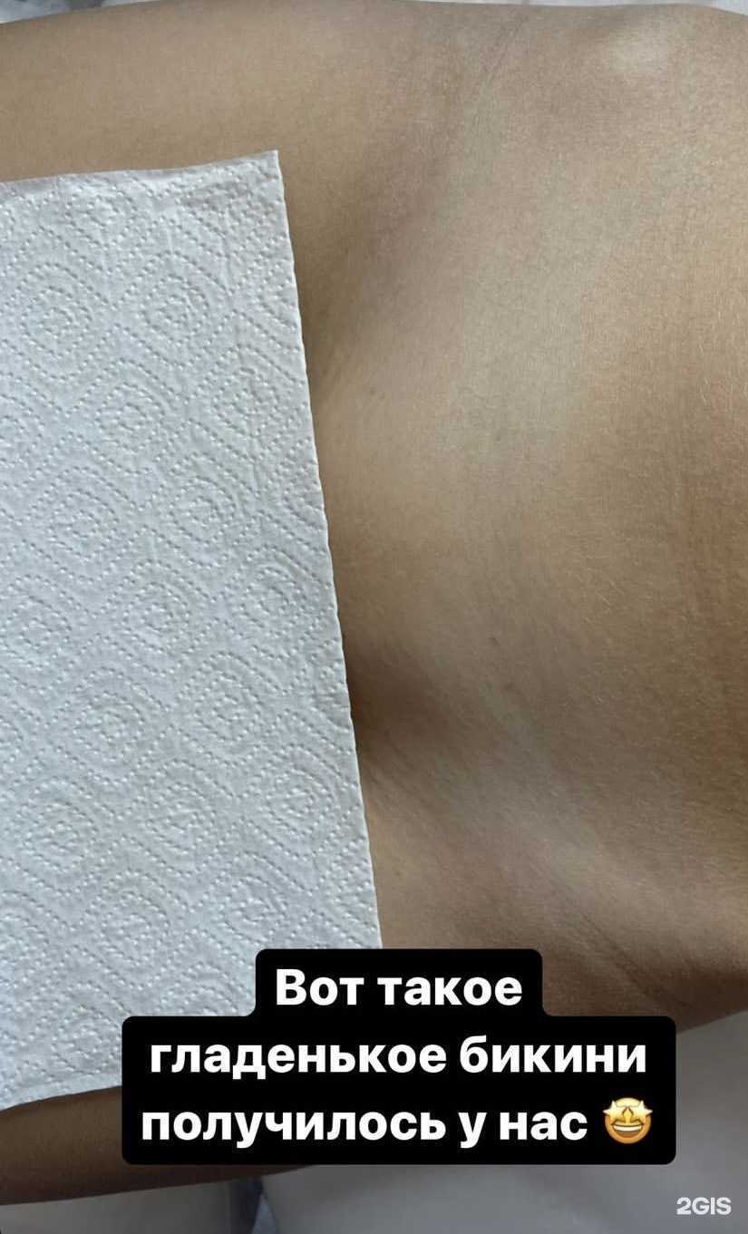 Отзывы на компанию Lasergenetic  в Казани c фото