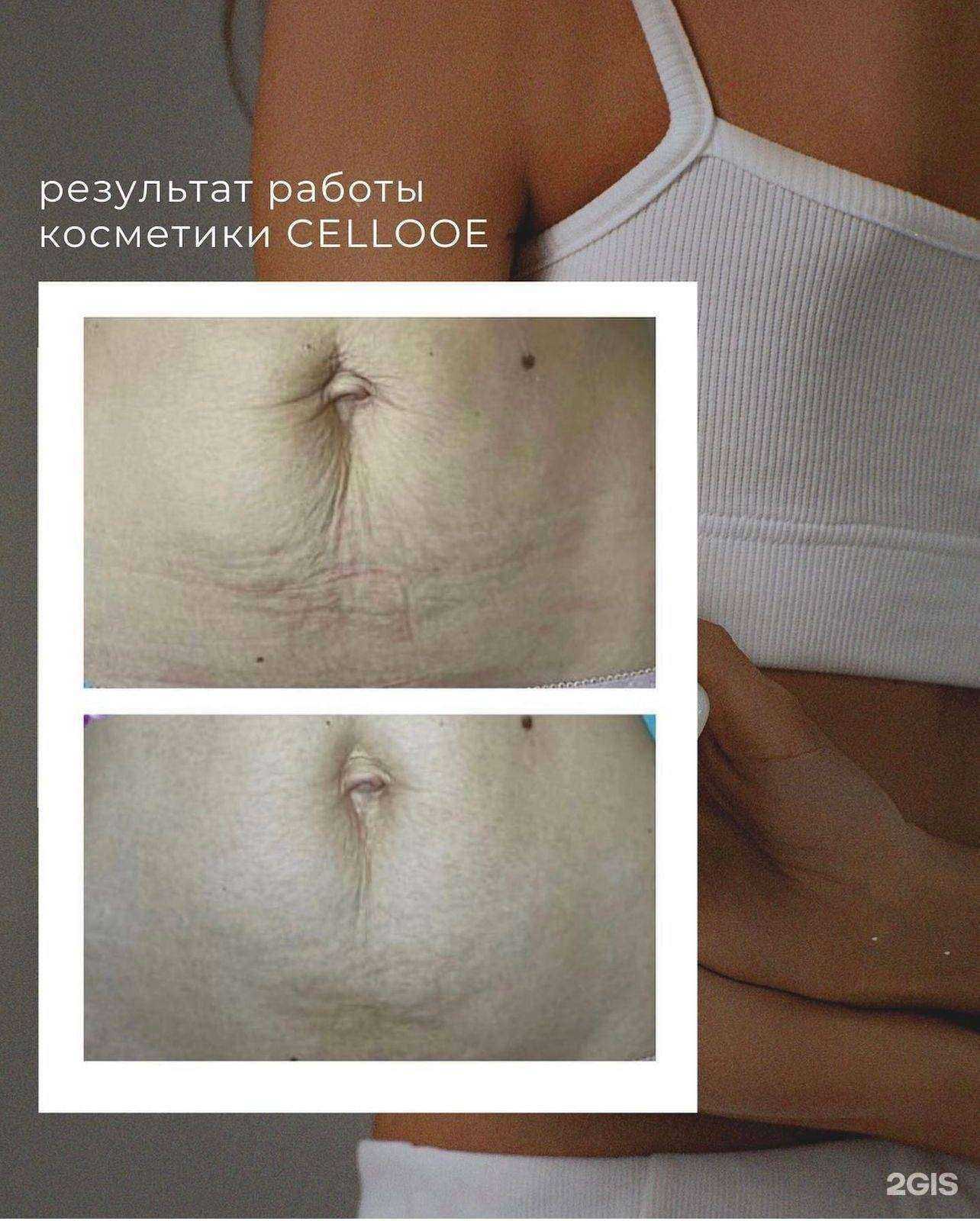 Отзывы на компанию Platinum в г. Кемерово c фото