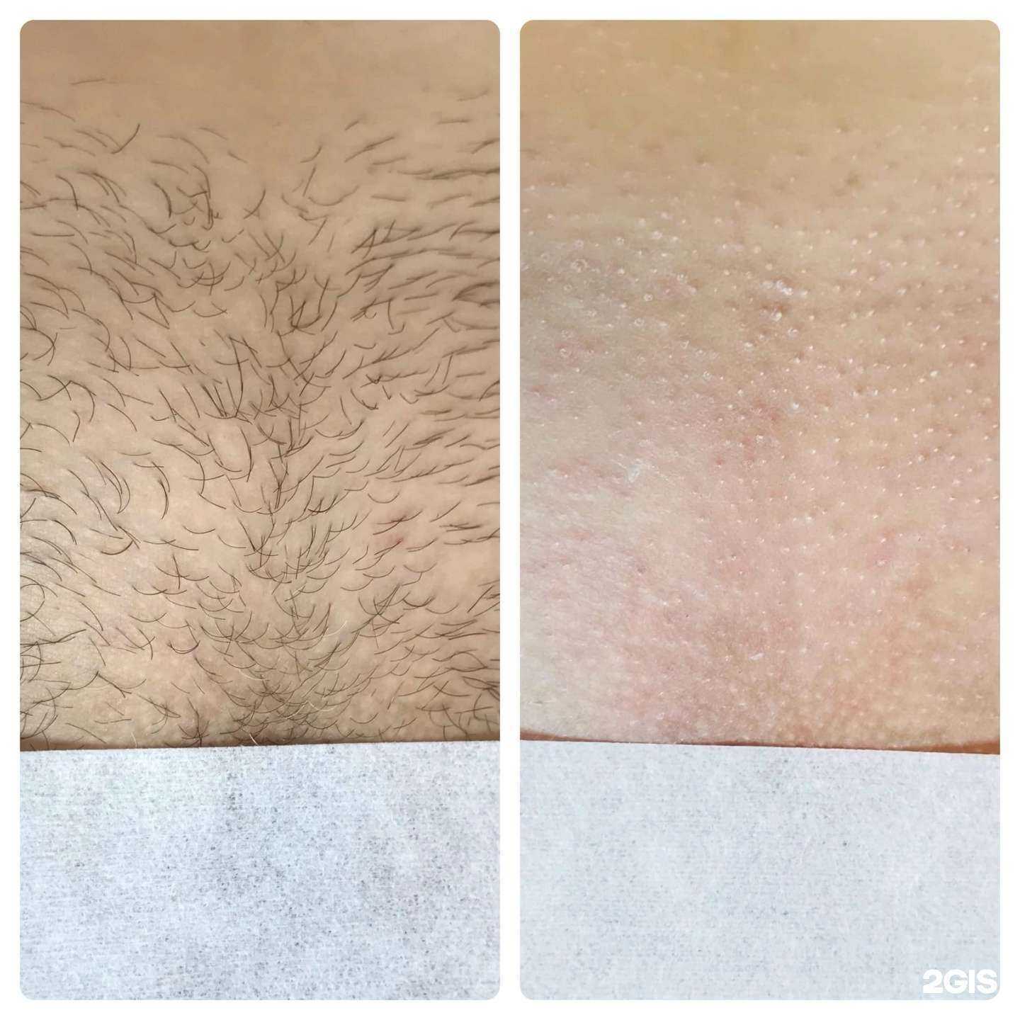 Отзывы на компанию Tomik в г. Крымск c фото