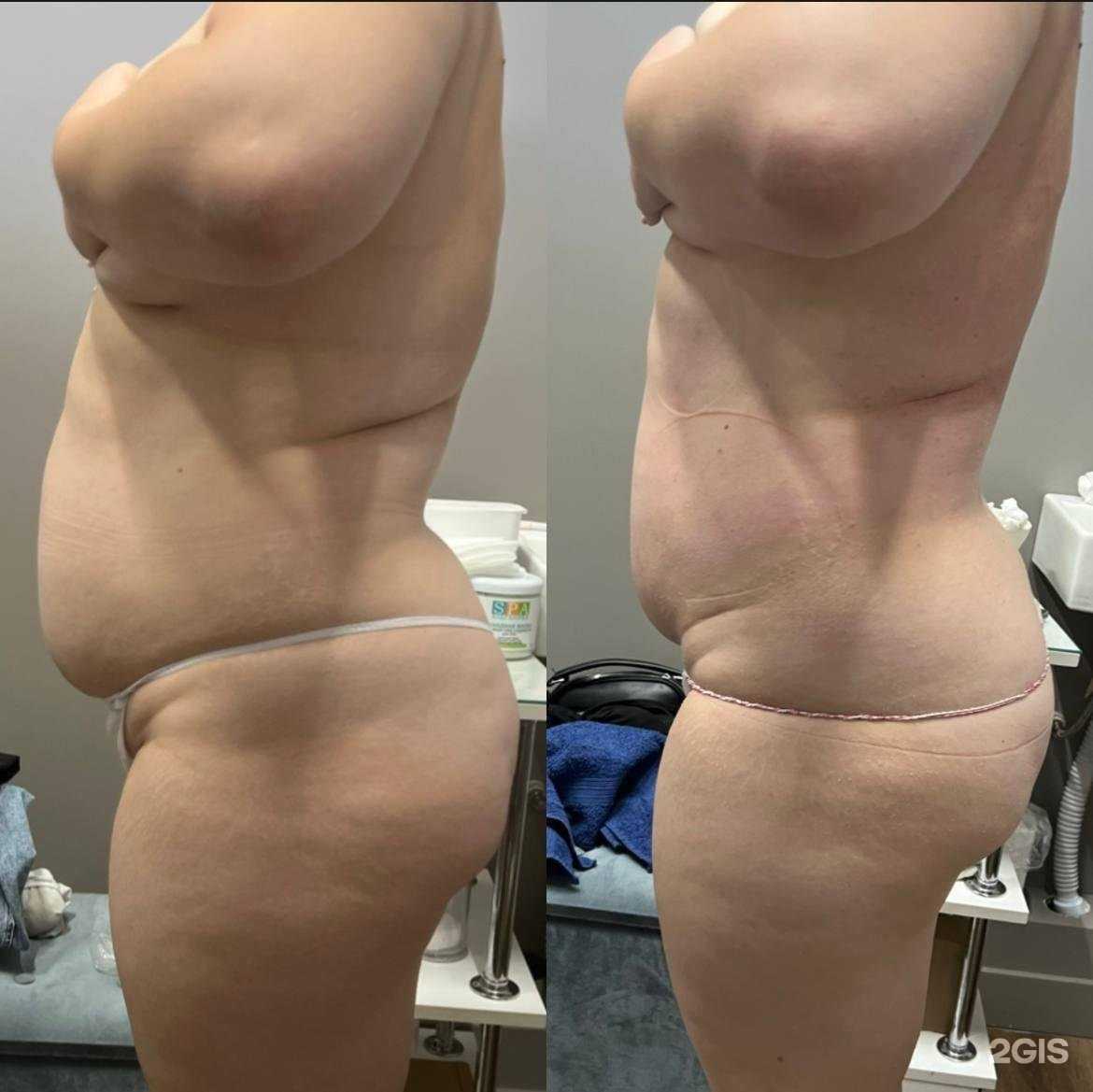 Отзывы на компанию Студия ручного и аппаратного массажа в г. Чита c фото