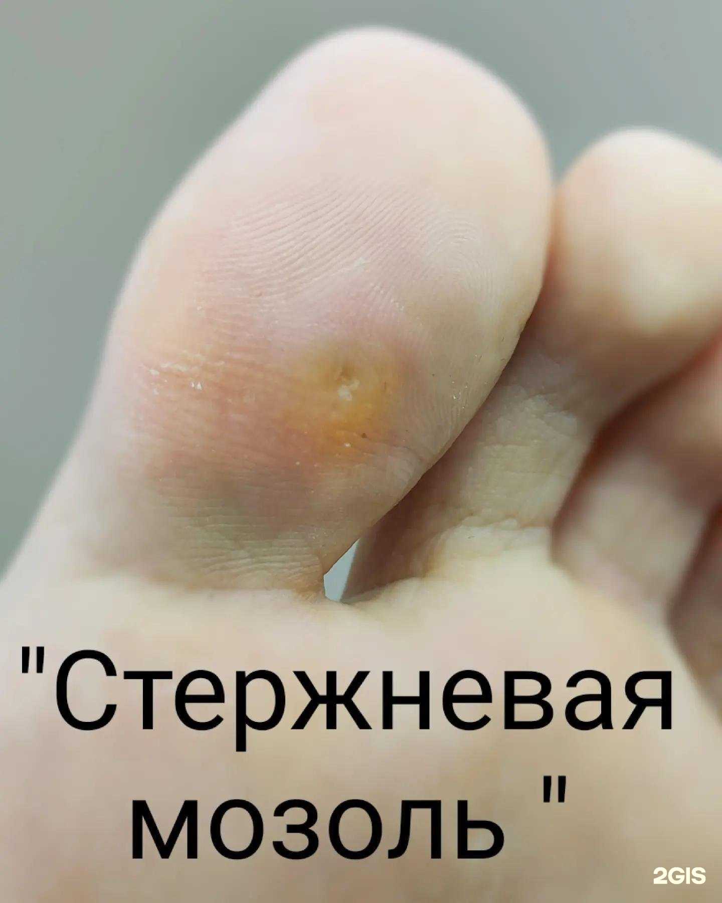 Отзывы на компанию Здоровая стопа в г. Красноярск c фото