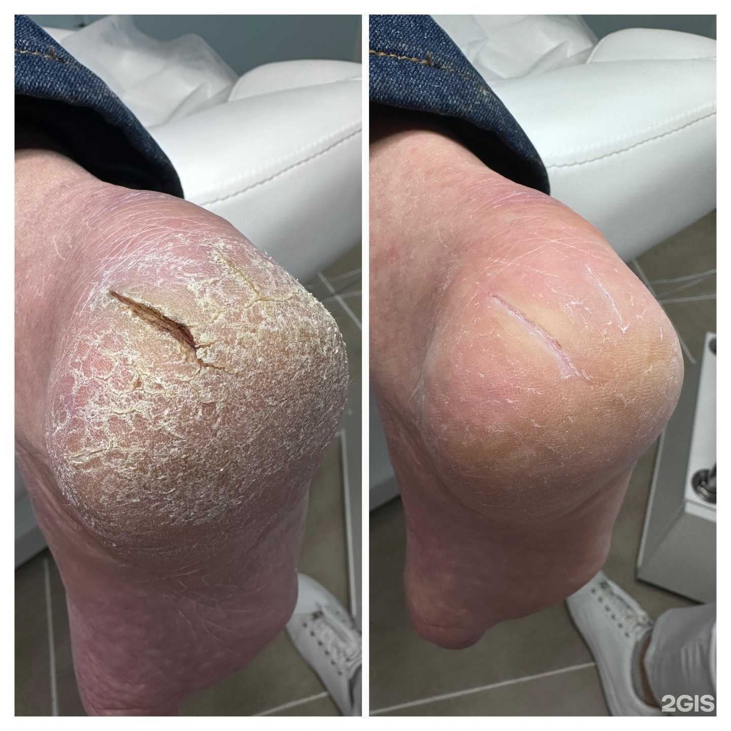 Отзывы на компанию Кабинет подолога в Уфе c фото