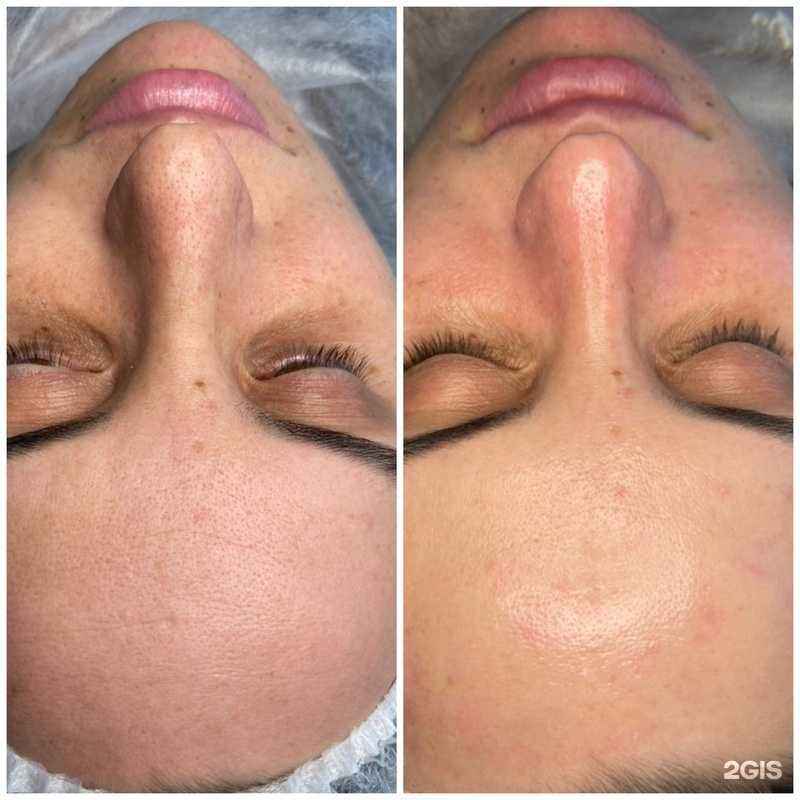 Отзывы на компанию Эдэм в г. Петропавловск-Камчатский c фото