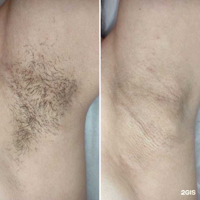 Отзывы на компанию Epil Lux в Ростове-на-Дону c фото