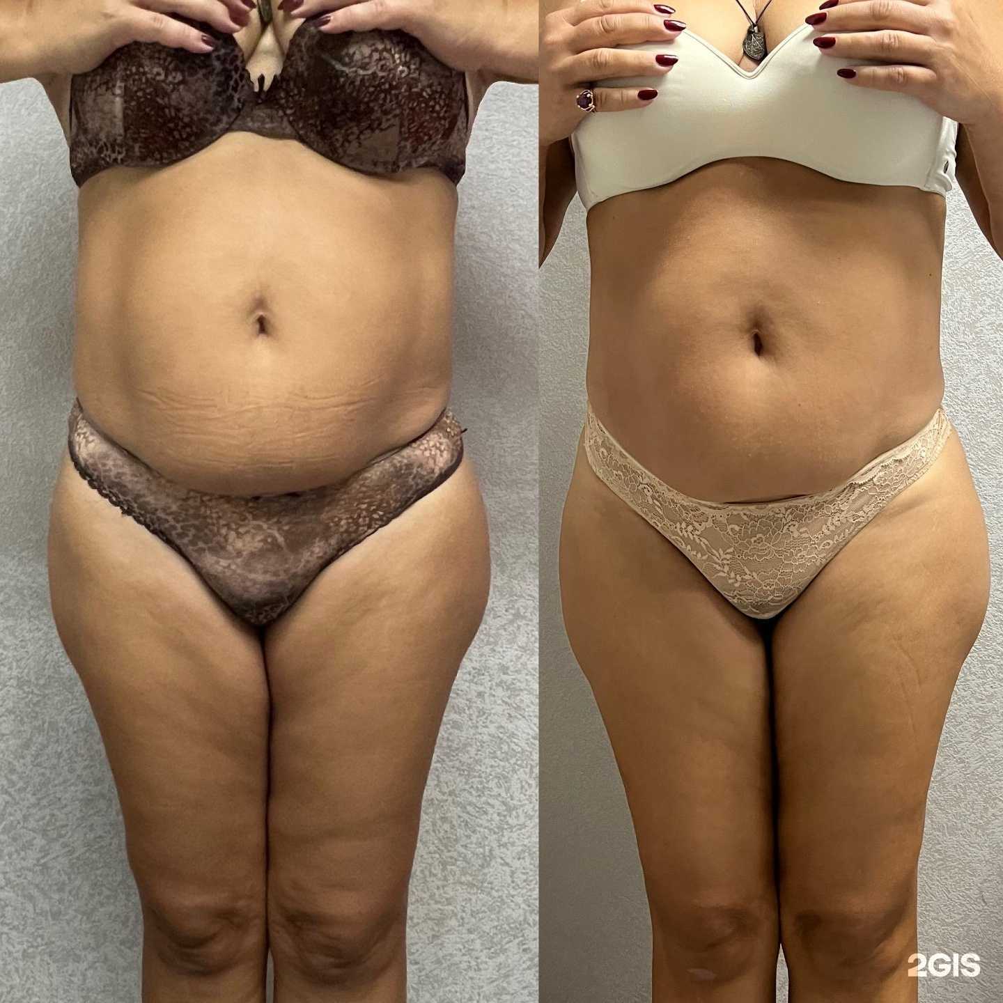 Отзывы на компанию Натура в г. Хабаровск c фото