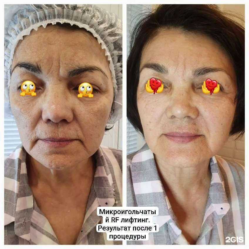 Отзывы на компанию Кабинет косметолога-эстетиста и нутрициолога в г. Геленджик c фото