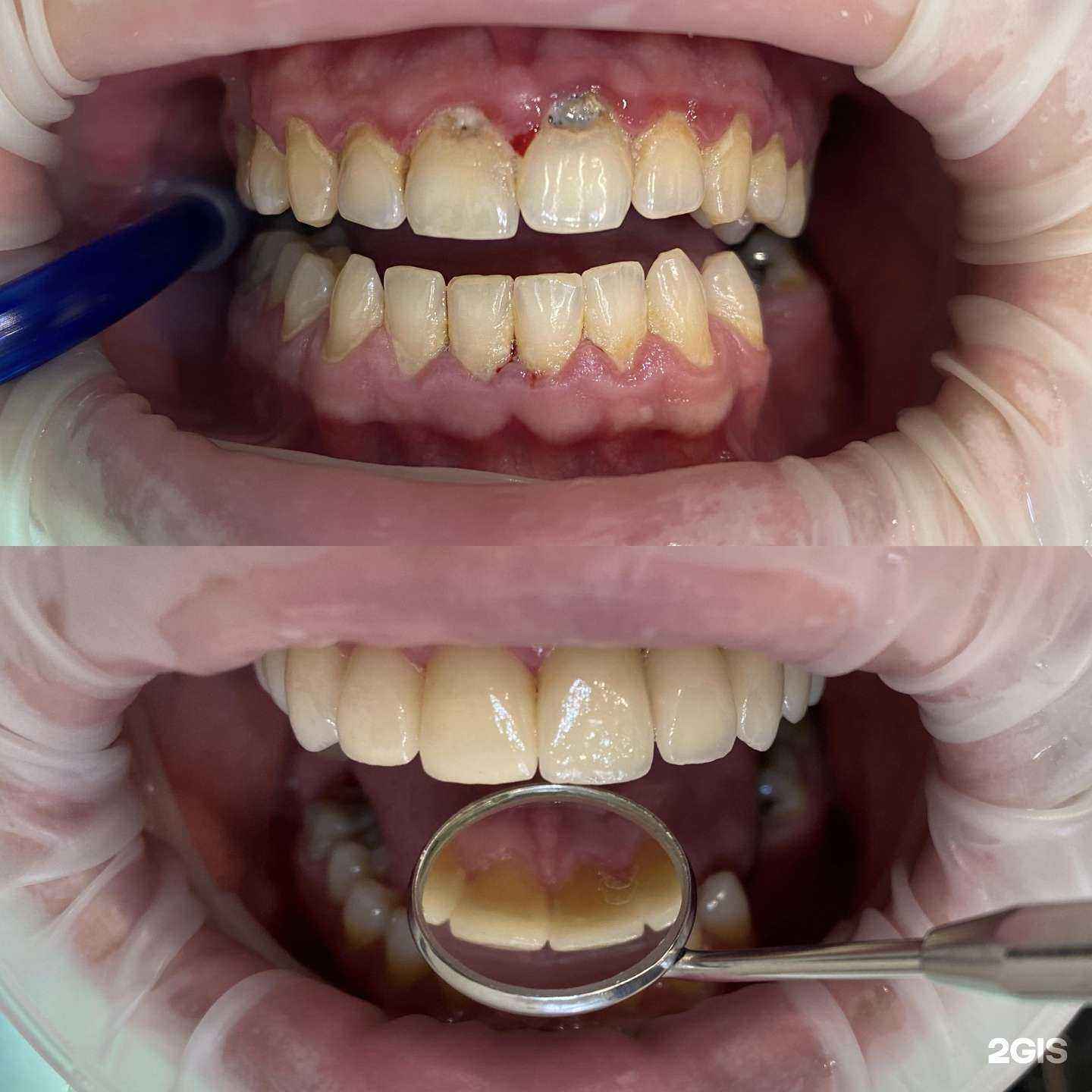 Отзывы на компанию VaDent в Ростове-на-Дону c фото