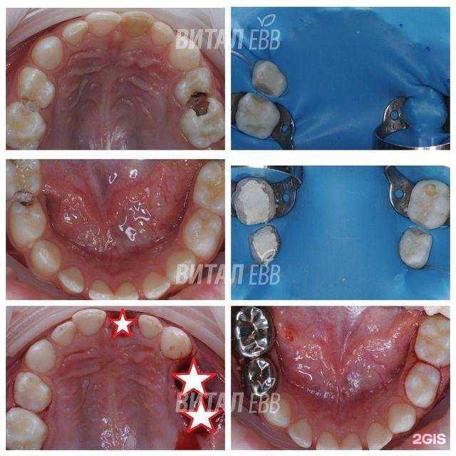 Отзывы на компанию Витал Евв в г. Екатеринбург c фото
