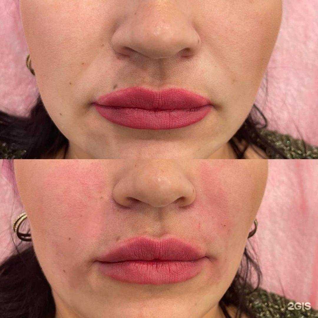 Отзывы на компанию Tina.Cosmetologist в Перми c фото