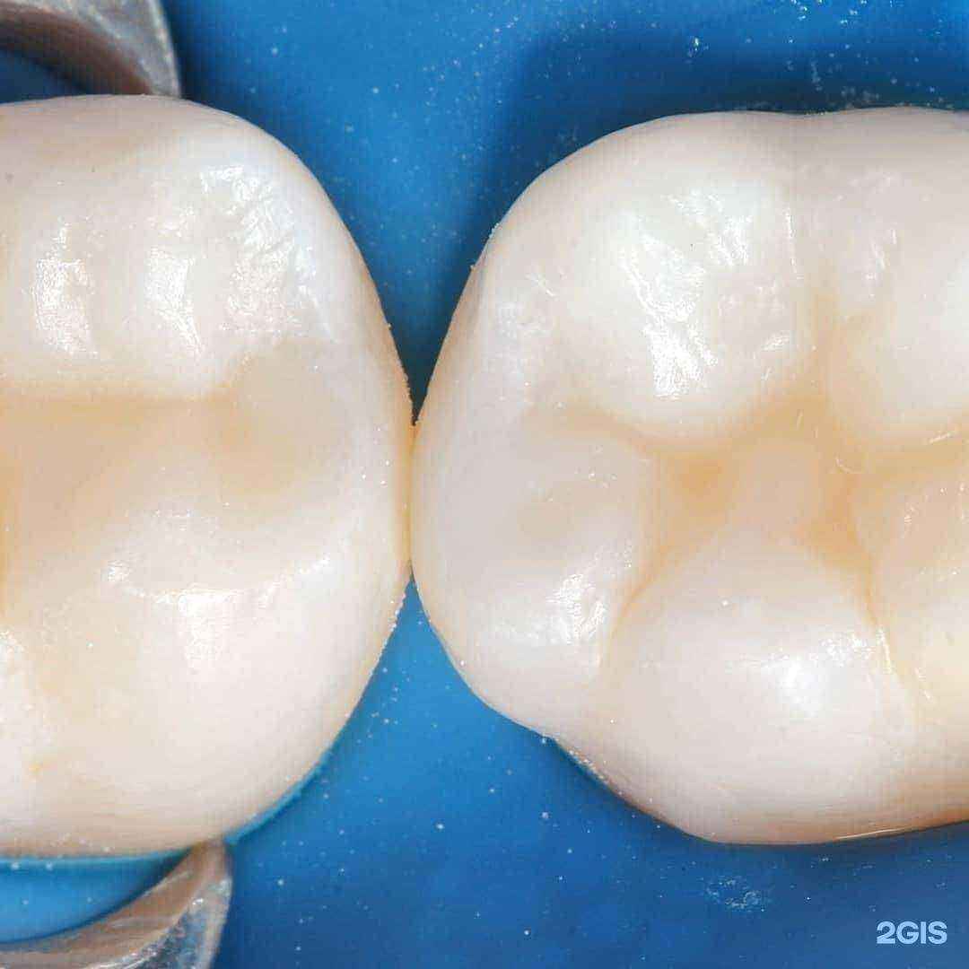 Отзывы на компанию Panda dental clinic в г. Самара c фото