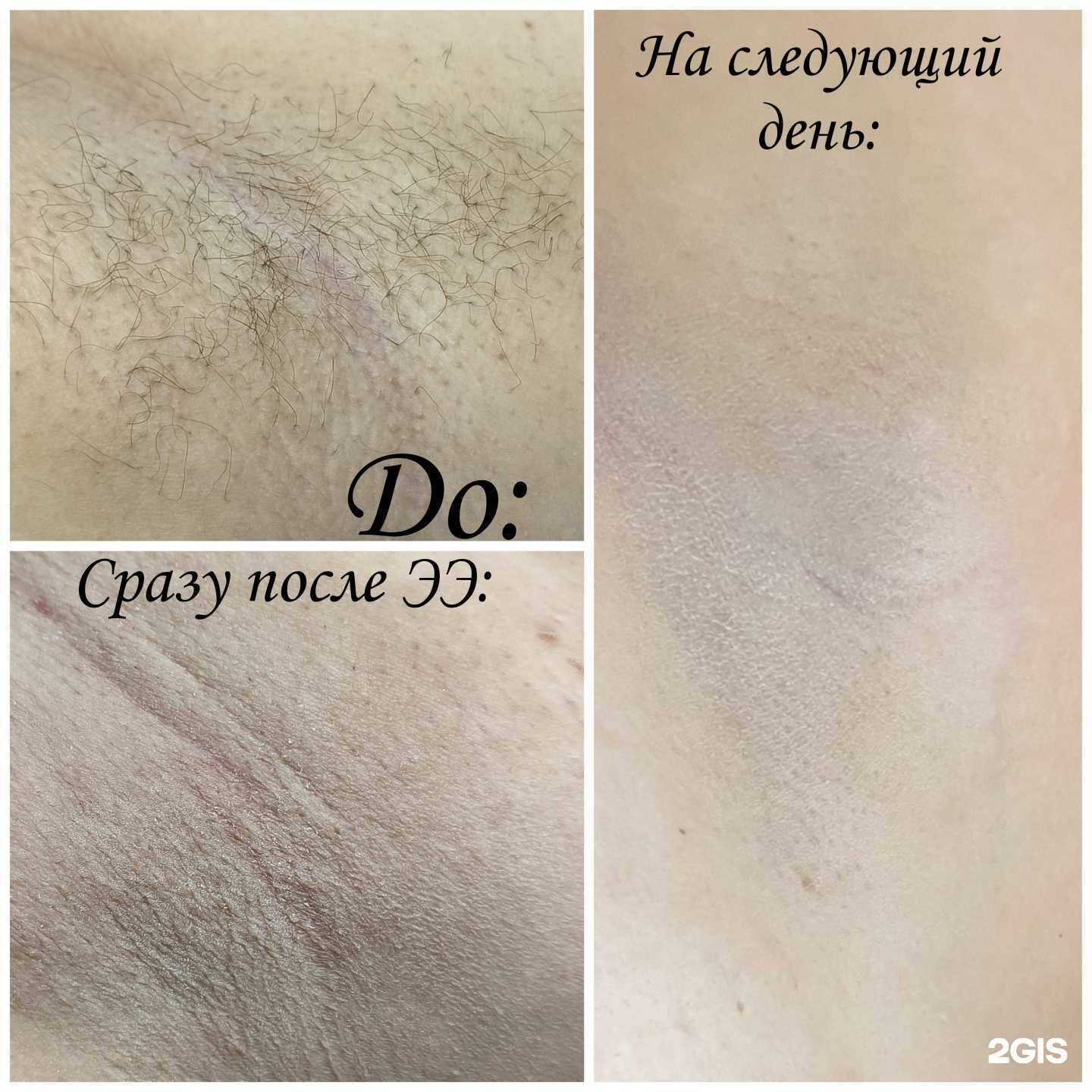 Отзывы на компанию Milya_epil в Ульяновске c фото