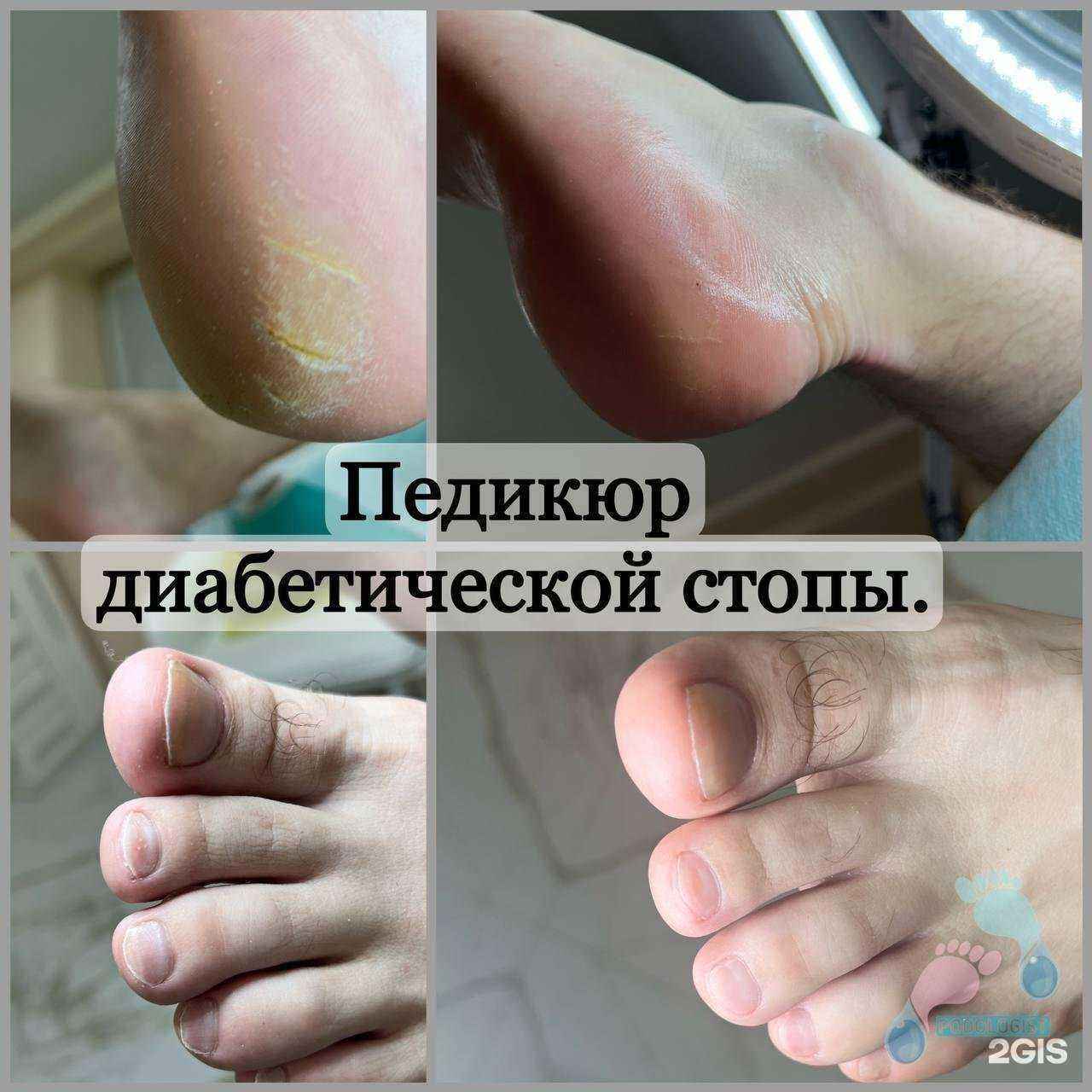 Отзывы на компанию Семейный центр подологии в Волгограде c фото