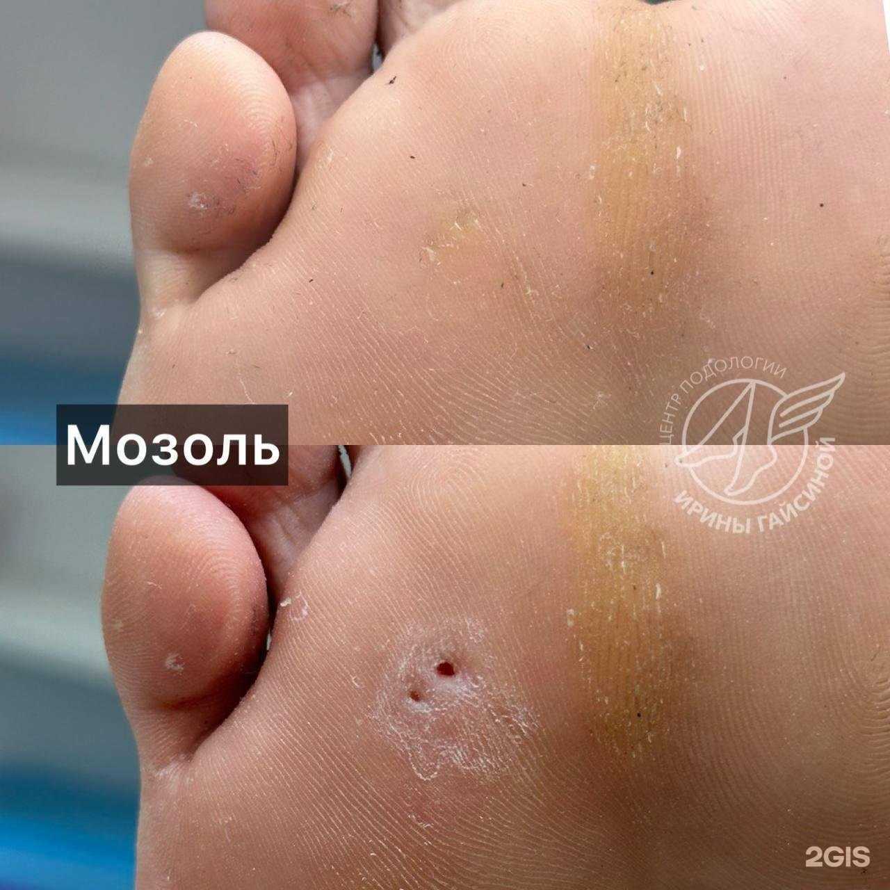 Отзывы на компанию Центр подологии Ирины Гайсиной в г. Оренбург c фото