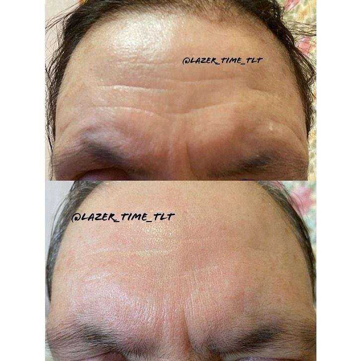 Отзывы на компанию Laser Time в Тольятти c фото